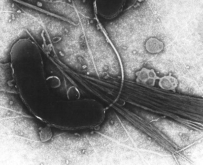 Vibrio cholerae, the bacterium that causes cholera